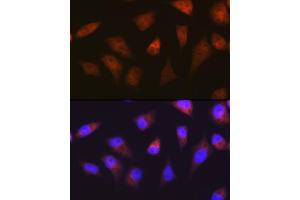Immunofluorescence analysis of HeLa cells using PSM Rabbit mAb (ABIN7269597) at dilution of 1:100 (40x lens). (PSMA2 antibody)