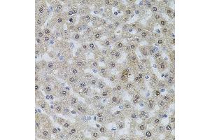 Immunohistochemistry of paraffin-embedded rat liver using POP4 antibody (ABIN5972510) at dilution of 1/100 (40x lens).