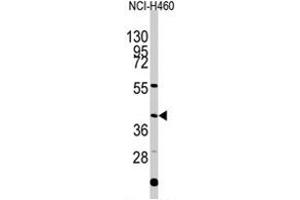 Western blot analysis of EN1 polyclonal antibody  in NCI-H460 cell line lysates (35 ug/lane).