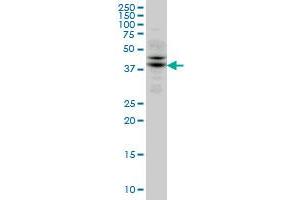 TRIB2 monoclonal antibody (M04), clone 1B1 Western Blot analysis of TRIB2 expression in Jurkat (ABIN1339540).