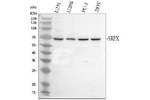 Western blot analysis of SRPX using anti-SRPX antibody (ABIN7825892).