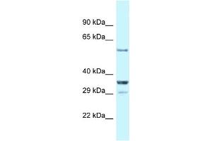 WB Suggested Anti-Cbll1 Antibody   Titration: 1.