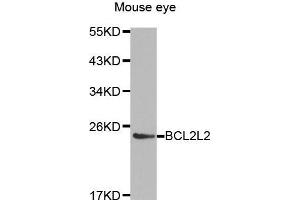 Western Blotting (WB) image for anti-BCL2-Like 2 (BCL2L2) (AA 1-193) antibody (ABIN3021581) (BCL2L2 antibody  (AA 1-193))
