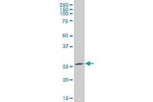 UCHL3 polyclonal antibody (A01). (UCHL3 antibody  (AA 131-230))