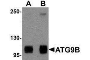 Western Blotting (WB) image for anti-Autophagy Related 9B (ATG9B) (C-Term) antibody (ABIN2477542)