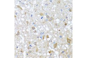 Immunohistochemistry of paraffin-embedded rat brain using EFHC1 antibody at dilution of 1:100 (x40 lens). (EFHC1 antibody)