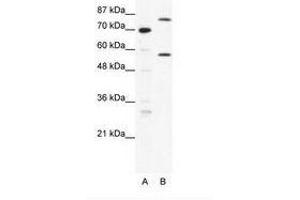 Image no. 1 for anti-Myoneurin (MYNN) (AA 371-420) antibody (ABIN202811) (Myoneurin antibody  (AA 371-420))