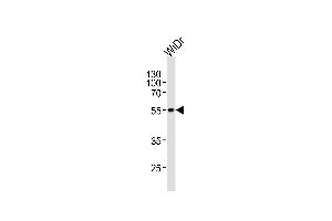 Western blot analysis of lysate from WiDr cell line, using hPDX1 (ABIN388773 and ABIN2839108).