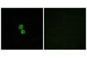 Immunofluorescence analysis of MCF-7 cells, using CKLF1 antibody. (CMTM1 antibody)