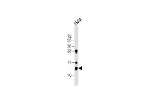 Anti-TrX Antibody (M1) at 1:1000 dilution + Hela whole cell lysate Lysates/proteins at 20 μg per lane.