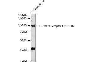 Western blot analysis of extracts of Mouse uterus, using TGF beta Receptor II (TGF beta Receptor II (TGFBR2)) antibody (ABIN6130735, ABIN6149085, ABIN6149088 and ABIN6215477) at 1:1000 dilution. (TGFBR2 antibody  (AA 23-280))