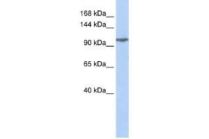 GRIK5 antibody used at 1 ug/ml to detect target protein. (GRIK5 antibody  (Middle Region))