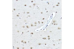 Immunohistochemistry of paraffin-embedded rat brain using Twist Rabbit pAb (ABIN6133951, ABIN6149713, ABIN6149716 and ABIN6220170) at dilution of 1:200 (40x lens). (TWIST1 antibody  (AA 1-100))