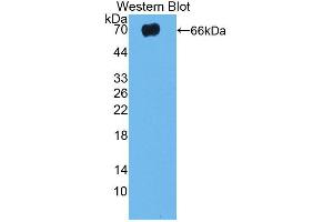Western blot analysis of the recombinant protein. (TLR5 antibody  (AA 325-644))