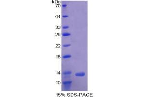SDS-PAGE analysis of Human ACVR1B Protein. (Activin A Receptor Type IB/ALK-4 Protein)
