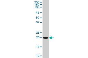 Western Blotting (WB) image for anti-Core-Binding Factor, beta Subunit (CBFB) (AA 74-163) antibody (ABIN560192)