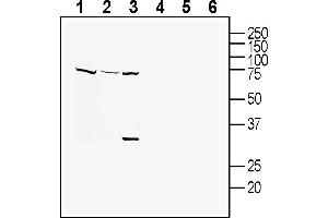 Western blot analysis of human  monocytic leukemia cell line lysates (lanes 1 and 4), human HUVEC endothelial cell line lysates (lanes 2 and 5) and mouse  microglia cell line lysate:1-3. (Tetraspanin 18 antibody  (Extracellular))