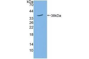Detection of Recombinant SIRT6, Mouse using Polyclonal Antibody to Sirtuin 6 (SIRT6) (SIRT6 antibody  (AA 1-334))