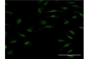 Immunofluorescence of monoclonal antibody to HNF1B on HeLa cell. (HNF1B antibody  (AA 29-118))