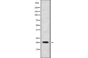 Western blot analysis of TNFRSF17 using Jurkat whole cell lysates (BCMA antibody  (Internal Region))