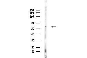 anti-Aristaless Related Homeobox (ARX) (Internal Region) antibody