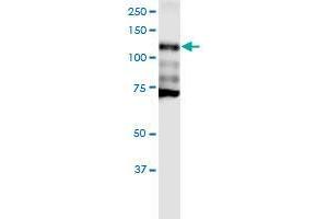 CDH1 monoclonal antibody (M01), clone 3F4.