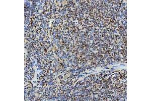 IHC analysis of SNRNP40 using anti-SNRNP40 antibody (ABIN7601719).