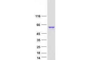 Validation with Western Blot (NCOA1 Protein (Transcript Variant 1) (Myc-DYKDDDDK Tag))