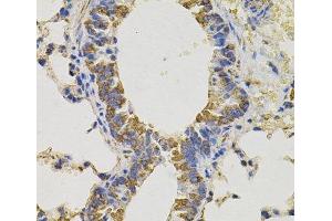 Immunohistochemistry of paraffin-embedded Mouse lung using PTPRC Polyclonal Antibody (CD45 antibody)