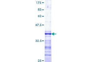TAO Kinase 1 (TAOK1) (AA 892-1001) protein (GST tag)