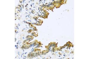 Immunohistochemistry of paraffin-embedded mouse lung using DEFB4A antibody at dilution of 1:100 (40x lens). (Defensin beta 4 antibody)