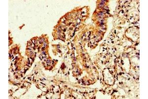Immunohistochemistry of paraffin-embedded human lung tissue using ABIN7153171 at dilution of 1:100 (FLI1 antibody  (AA 205-331))