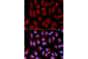 Immunofluorescence analysis of U2OS cell using TAP2 antibody. (TAP2 antibody)