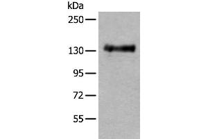 Western blot analysis of Mouse brain tissue lysate using PTPRA Polyclonal Antibody at dilution of 1:400 (PTPRA antibody)
