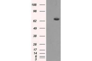 HEK293T cells were transfected with the pCMV6-ENTRY control (Left lane) or pCMV6-ENTRY HDAC10 (Right lane) cDNA for 48 hrs and lysed. (HDAC10 antibody)