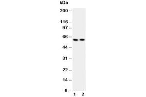 Western blot testing of Src antibody and Lane 1:  COLO320 (Src antibody  (AA 2-368))