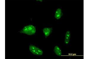 Immunofluorescence of monoclonal antibody to ZNF611 on HeLa cell. (ZNF611 antibody  (AA 1-151))