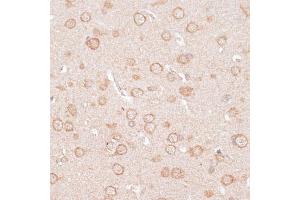 Immunohistochemistry of paraffin-embedded rat brain using KCNJ4 antibody (ABIN6134096, ABIN6142734, ABIN6142737 and ABIN6218214) at dilution of 1:100 (40x lens). (KCNJ4 antibody  (AA 50-150))