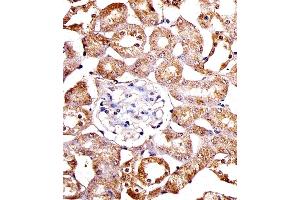 Immunohistochemical analysis of paraffin-embedded M. (SPHK1 antibody  (N-Term))