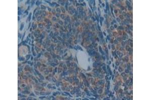 IHC-P analysis of Rat Tissue, with DAB staining. (PZP antibody  (AA 1251-1500))
