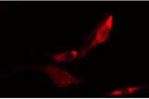 ABIN6275120 staining  HeLa cells by IF/ICC. (EIF3K antibody  (N-Term))