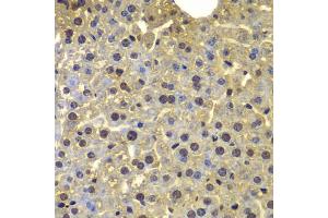 Immunohistochemistry of paraffin-embedded mouse liver using SORT1 antibody (ABIN5975318) at dilution of 1/100 (40x lens). (Sortilin 1 antibody)