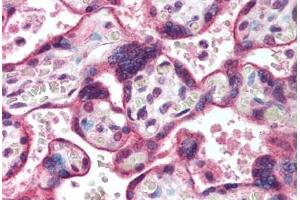 Human Placenta (formalin-fixed, paraffin-embedded) stained with HDAC3 antibody ABIN291844 at 10 ug/ml followed by biotinylated goat anti-rabbit IgG secondary antibody ABIN481713, alkaline phosphatase-streptavidin and chromogen. (HDAC3 antibody  (AA 2-17))