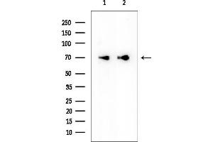 anti-Solute Carrier Family 39 (Zinc Transporter), Member 12 (SLC39A12) antibody