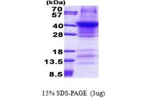 SDS-PAGE (SDS) image for Renin (REN) (AA 67-406) protein (His tag) (ABIN5853052)