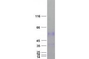 Validation with Western Blot