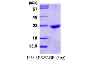 SDS-PAGE (SDS) image for RAB22A, Member RAS Oncogene Family (RAB22A) (AA 1-194) protein (His tag) (ABIN667558) (RAB22A Protein (AA 1-194) (His tag))