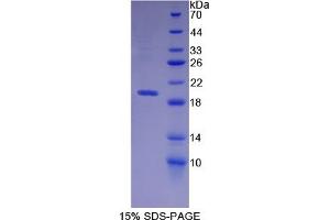 SDS-PAGE of Protein Standard from the Kit  (Highly purified E. (MME ELISA Kit)