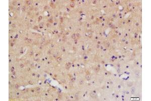 Formalin-fixed and paraffin embedded rat brain labeled with Rabbit Anti-PTPN11 (Tyr584) Polyclonal Antibody, Unconjugated 1:200 followed by conjugation to the secondary antibody and DAB staining (PTPN11 antibody  (pTyr584))