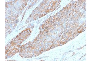 Formalin-fixed, paraffin-embedded human Pancreas stained with Spectrin Beta 3 Rabbit Monoclonal Antibody (SPTBN2/2979R).